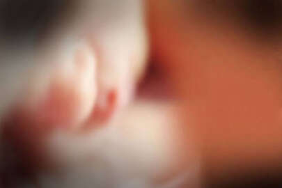 Bebek yüzü olmadan dünyaya geldi, doğum uzmanı doktor açığa alındı