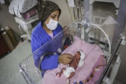 Ölüm riski bulunan üçüzlerden ikisi anne karnında ışın tedavisiyle kurtarıldı
