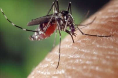 İstanbul'da yayılımı artan "Aedes" sivrisineği alerjik reaksiyona yol açıyor