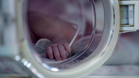 Dünyaya 430 gram gelen prematüre bebeğe kalp ameliyatı