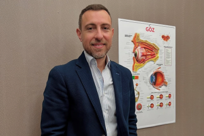 Keratokonus Tedavisinde Yeni Dönem: CAIRS (Keranatural) Yöntemi