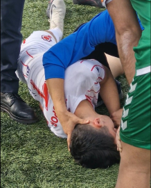 Amatör maçta futbolcu bilincini kaybetti