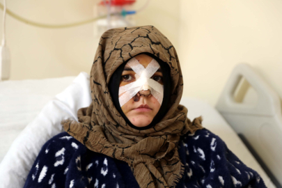 Eşinin kaldırım taşı ile dövdüğü Nazlı: Çıkarsa yarım bıraktığı işi tamamlar