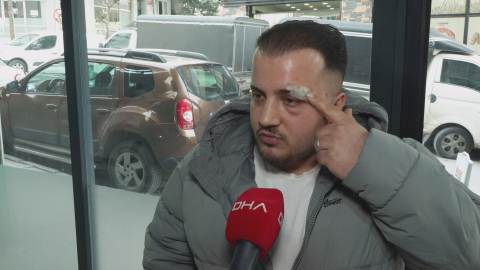 İstanbul- Eyüpsultan’da ‘yol verme’ kavgasında darbettiği sürücüyü tanımazlıktan geldi