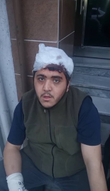 Sultangazi'de zihinsel engelli ve annesine sopalı saldırı