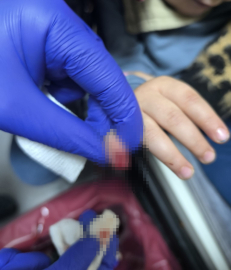 Yürüyen merdivene eli sıkışan çocuğun kopan parmağı kurtarılamadı